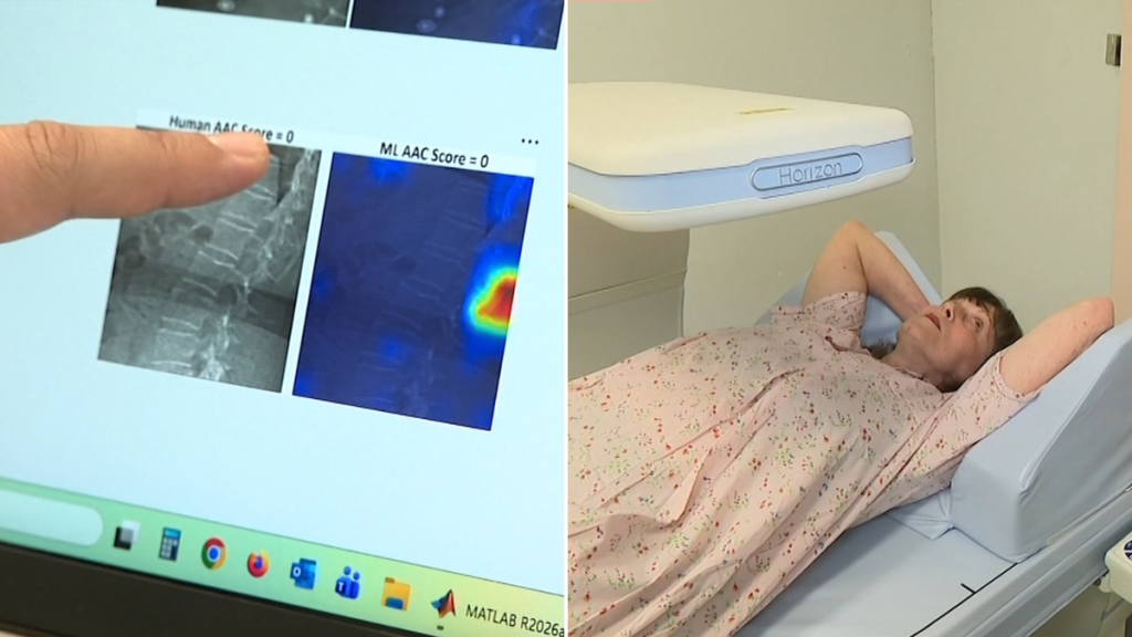 Australian researchers use artificial intelligence to detect heart disease years before heart attack Australian researchers use artificial intelligence to detect heart disease years before heart attack